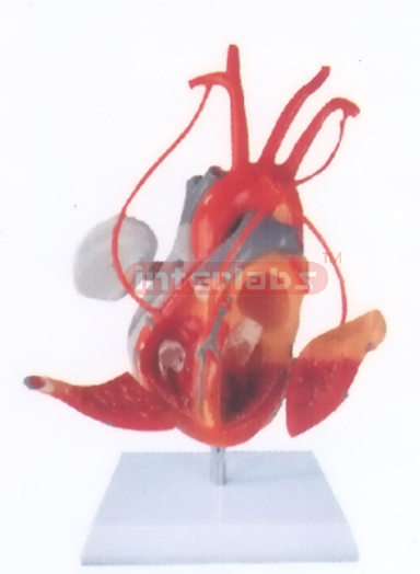 MIDDLE HEART MODEL WITH BYPASS